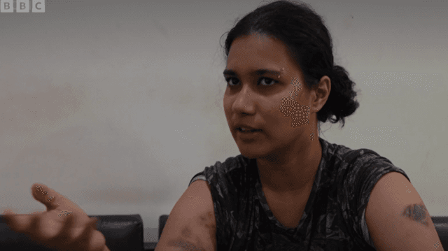 দুই হাতে আঘাতের চিহ্ন দেখাচ্ছেন নাদিয়া